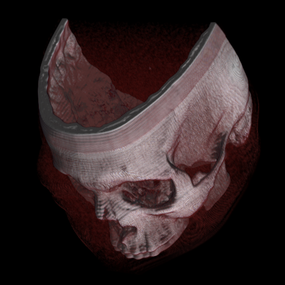 3D Volume